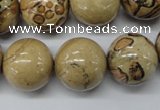 CLD51 15.5 inches 18mm round African leopard skin jasper beads