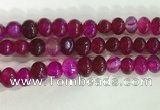CNG8330 15.5 inches 10*12mm nuggets agate beads wholesale