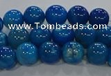 CAA1057 15.5 inches 8mm round dragon veins agate beads wholesale