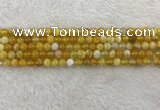 CAA1850 15.5 inches 4mm round banded agate gemstone beads