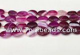 CAA4663 15.5 inches 13*18mm oval banded agate beads wholesale