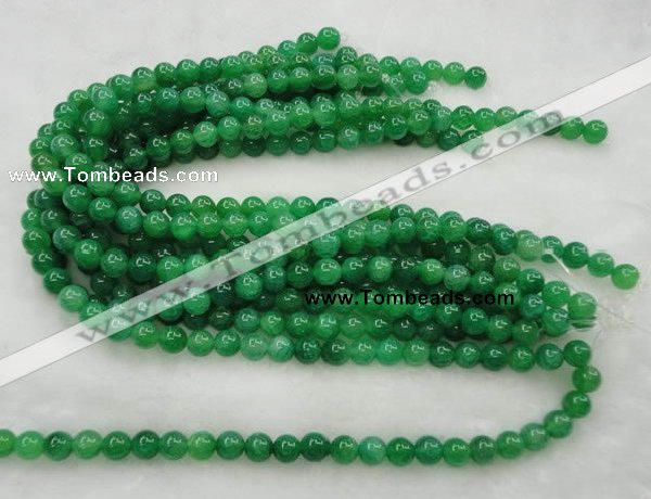 CAG420 15.5 inches 10mm round green agate beads Wholesale