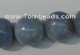 CAG4376 15.5 inches 18mm round dyed blue lace agate beads