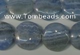 CAG4382 15.5 inches 20mm flat round dyed blue lace agate beads