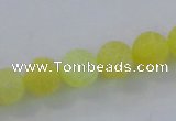 CAG7519 15.5 inches 6mm round frosted agate beads wholesale