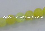 CAG7520 15.5 inches 8mm round frosted agate beads wholesale