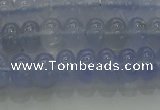 CBC441 15.5 inches 5*8mm rondelle blue chalcedony beads