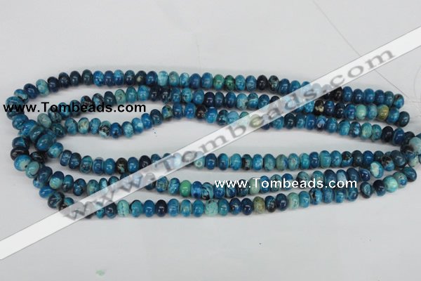 CCO170 15.5 inches 5*8mm rondelle dyed natural chrysotine beads