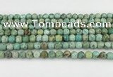 CCO368 15.5 inches 7mm round chrysotine gemstone beads wholesale