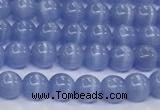 CCT1410 15 inches 4mm, 6mm round cats eye beads