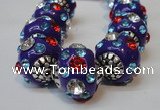 CIB105 17mm round fashion Indonesia jewelry beads wholesale