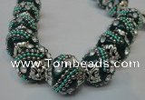 CIB183 18mm round fashion Indonesia jewelry beads wholesale