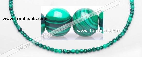 CMA19 15.5 inches 5mm round imitate malachite beads Wholesale