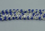 CPB541 15.5 inches 6mm round Painted porcelain beads