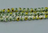 CPB732 15.5 inches 8mm round Painted porcelain beads