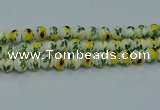 CPB733 15.5 inches 10mm round Painted porcelain beads