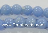 CTU1736 15.5 inches 14mm round synthetic turquoise beads