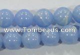 CTU1737 15.5 inches 16mm round synthetic turquoise beads