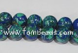 CTU1814 15.5 inches 10mm round synthetic turquoise beads